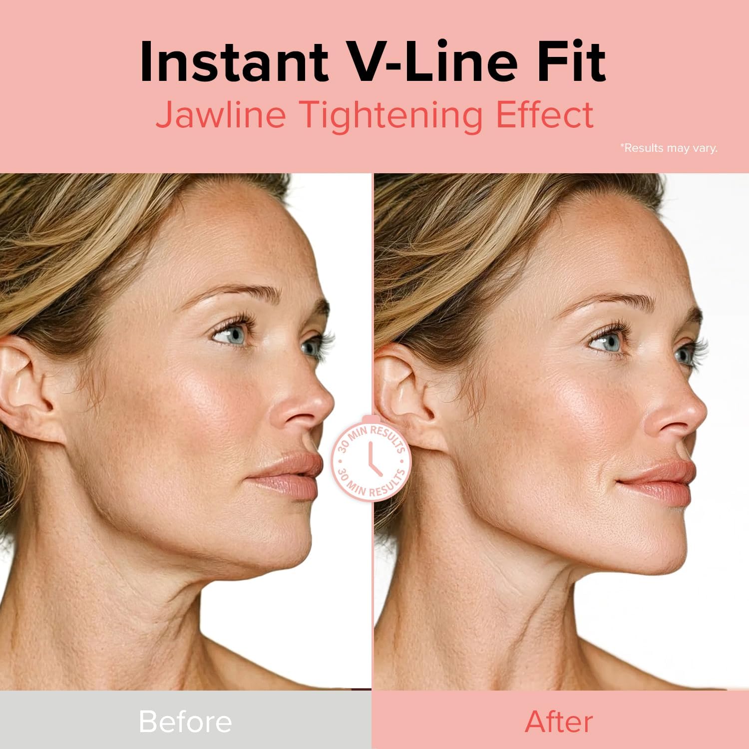 id FACE FIT MINUS BAND V2 (4ea)